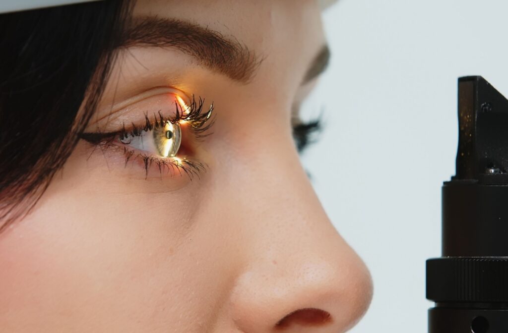 A patient at their eye doctor getting a slit lamp exam